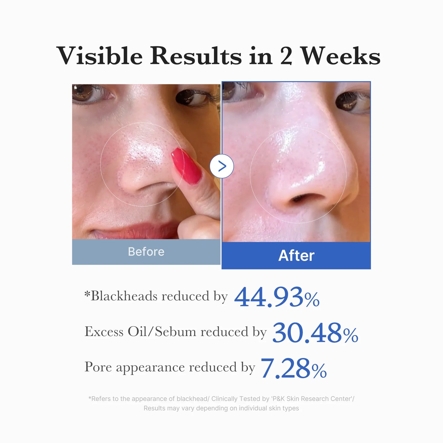 Zero Pore Pad 2.0