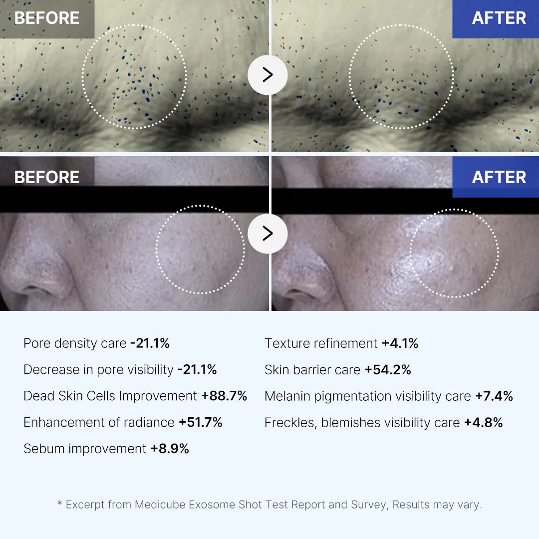 One Day Exosome Shot Pore Ampoule 7500